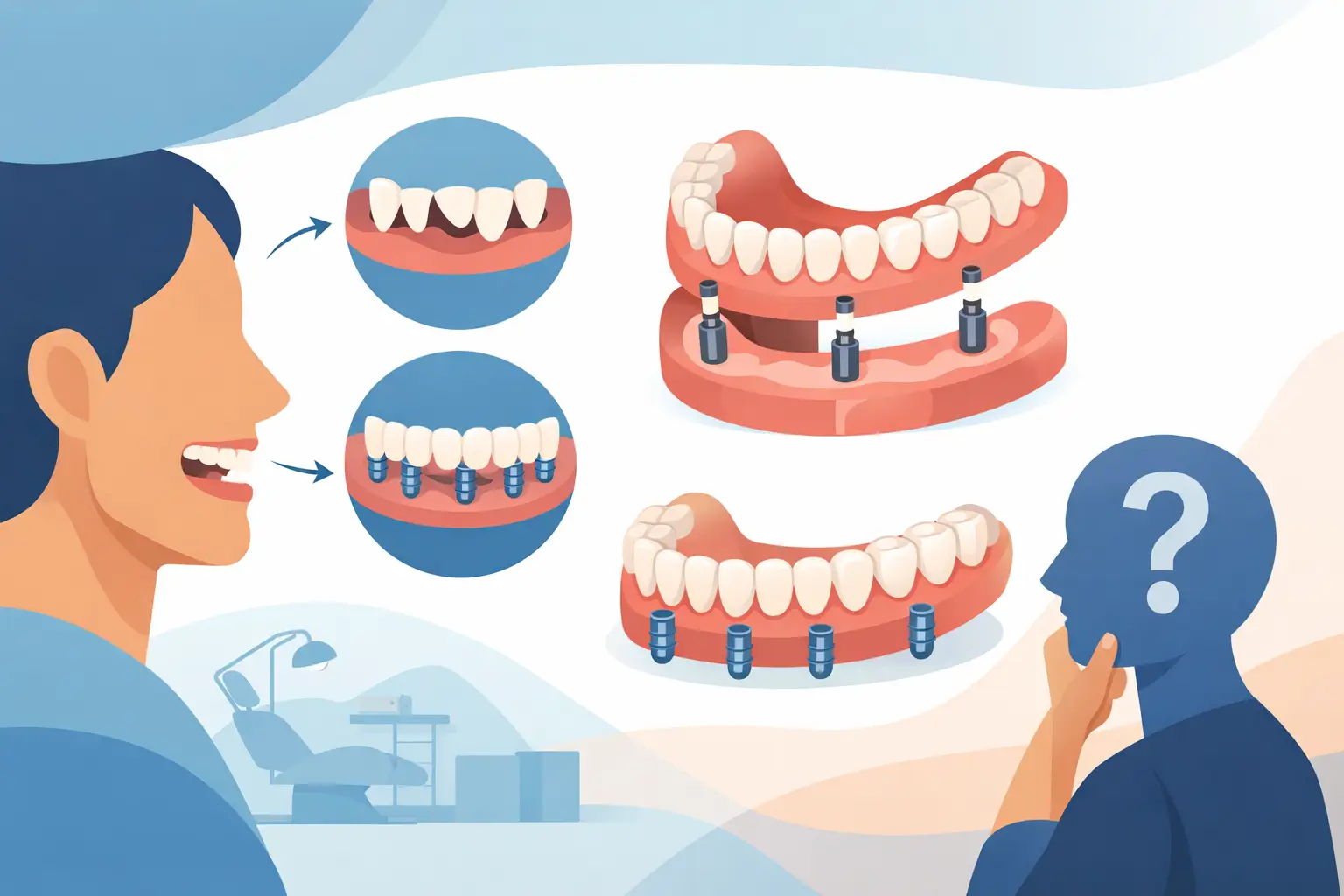 Is a Full Arch Transformation Right for You?